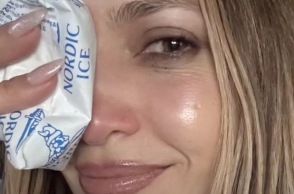 Το ατύχημα της Τζένιφερ Λόπεζ στις πρόβες 