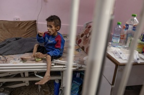 Υποσιτισμένο παιδί στη Γάζα