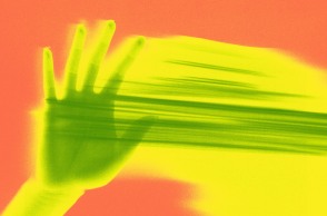 Πεθαίνω, με βλέπεις;