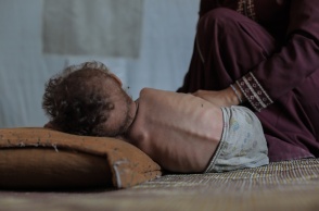 Μωρό αδυνατισμένο σε κρεβάτι στη Γάζα