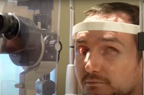 Ο Μπρεντ Τσάπμαν, τυφλός επί 20 χρόνια, ξαναβρήκε την όρασή του χάρη σε σπάνια επέμβαση «δόντι-στο-μάτι» που πραγματοποιήθηκε στον Καναδά.