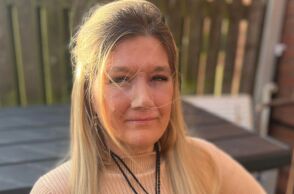 Ηνωμένο Βασίλειο: Η Έλεν ΜακΚλίρι, 46 ετών, έχασε τη μύτη της λόγω καρκίνου που αρχικά διαγνώστηκε λανθασμένα ως αλλεργία - Σήμερα ζει με προσθετική μύτη.