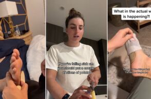 Χιλιάδες χρήστες βάζουν φέτες πατάτας στις κάλτσες πριν τον ύπνο πιστεύοντας ότι αποτοξινώνουν τον οργανισμό - Οι γιατροί διαψεύδουν τον «θαυματουργό» μύθο.