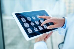 Μελέτη του Πανεπιστημίου Κέιμπριτζ: Ο εγκέφαλος μένει σε εφηβική φάση έως τα 32, με κρίσιμες αλλαγές στα 9, 32, 66 και 83 έτη.