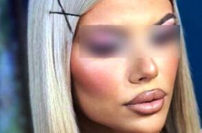 Κεφαλονιά: Μυστήριο με τους ενοίκους του ξενοδοχείου το μοιραίο βράδυ - Ποιοι έμεναν εκεί