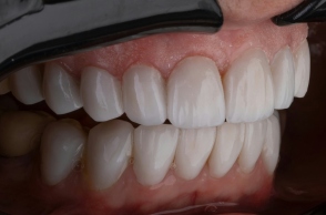 Ο αγώνας μιας γυναίκας να σώσει τα δόντια της, της κόστισε τη δουλειά και την υγεία της