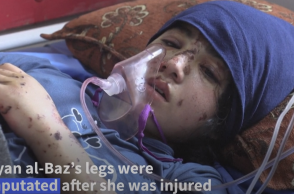 Η 13χρονη έχασε και τα δύο της πόδια μετά από βομβαρδισμό στη Γάζα