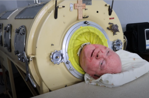 Ο Paul Alexander ζούσε σε σιδερένιο πνεύμονα