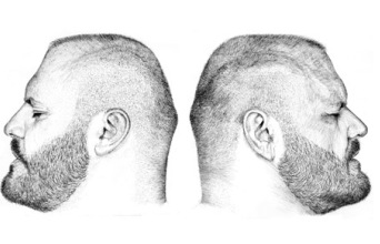 Έργα του José Manuel Hortelano-Pi από την έκθεση στο μπιλιαρδάδικο της Μαυρομιχάλη