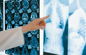 Ακτινογραφίες πνευμόνων