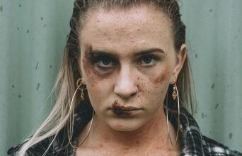 Κακοποιημένη γυναίκα