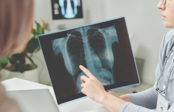 Καρκίνος του Πνεύμονα: Οι νέες θεραπευτικές προσεγγίσεις