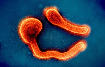 Ο γιατρός Γιώργος Παππάς μιλά για τον θανατηφόρο ιό Μάρμπουργκ