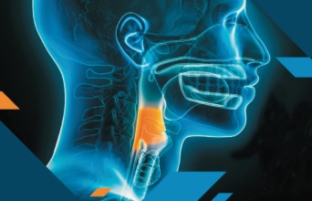 Η θέση του laser στην ωτορινολαρυγγολογία και τη φωνοχειρουργική