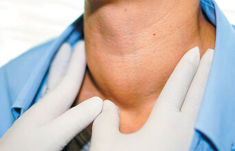 Υπερθυρεοειδισμός: Τι προβλήματα μπορεί να δημιουργήσει και πώς αντιμετωπίζεται;