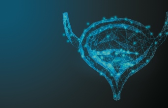 Αναίμακτη θεραπεία καρκίνου του προστάτη  