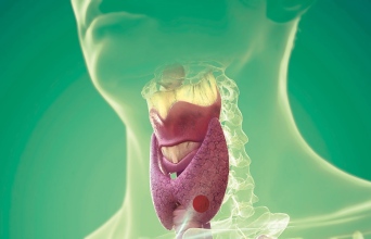 Όζοι θυρεοειδούς – 9 συχνές ερωτήσεις και απαντήσεις