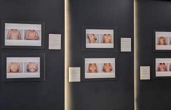 Σύλβια Κουβέλη: «Θέλω οι εκθέσεις του boobs να γίνουν αφορμή για να ανοίξει μια δύσκολη συζήτηση»