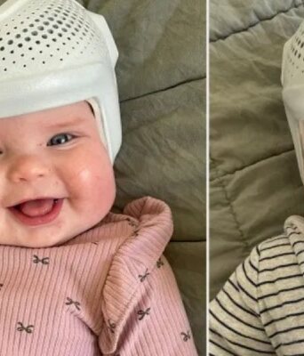 Φοράει κράνη στα δίδυμα μωρά της και εξηγεί το γιατί