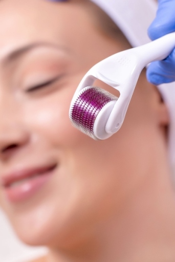 Derma Rolling: Λειτουργεί τελικά ή χαλάμε τζάμπα το δέρμα μας;