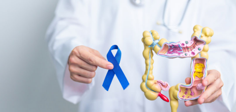 καρκίνος παχέος εντέρου