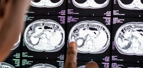 Καρκίνος: Εννιά εξετάσεις που πρέπει να κάνει κάθε ενήλικας για την πρόληψή του 