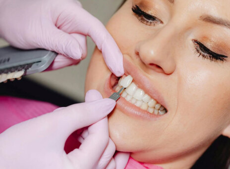 Όψεις πορσελάνης