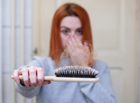 Τριχόπτωση