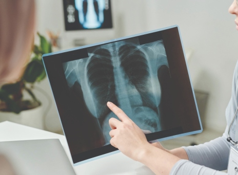 Καρκίνος του Πνεύμονα: Οι νέες θεραπευτικές προσεγγίσεις