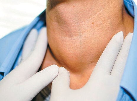 Υπερθυρεοειδισμός: Τι προβλήματα μπορεί να δημιουργήσει και πώς αντιμετωπίζεται;