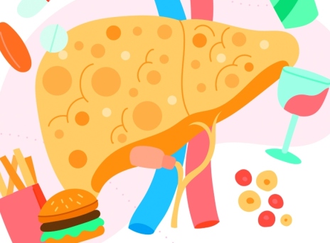 Λιπώδης διήθηση ήπατος | Μέθοδοι πρόληψης και θεραπεία