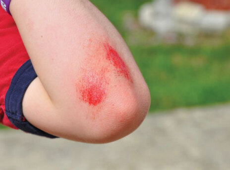 Μικρές πληγές, μεγάλοι μπελάδες