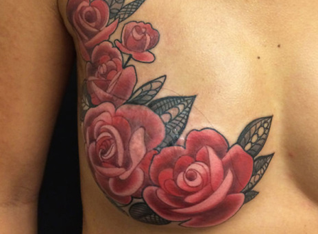 Μεταμορφώνοντας τις πληγές σε τριαντάφυλλα 