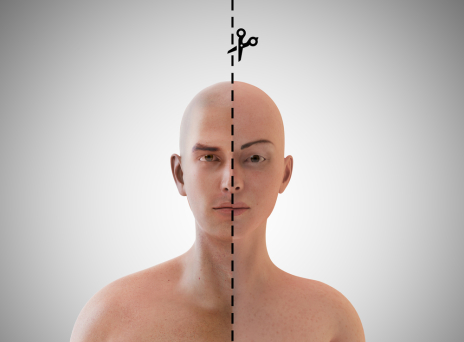 Αλλαγή φύλου άρπα κόλλα;