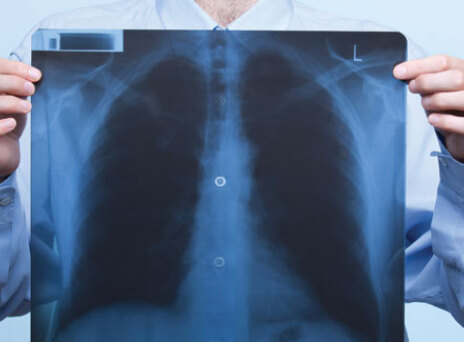 Νivolumab: σημαντική θεραπευτική επιλογή σε πολλαπλούς τύπους καρκίνου