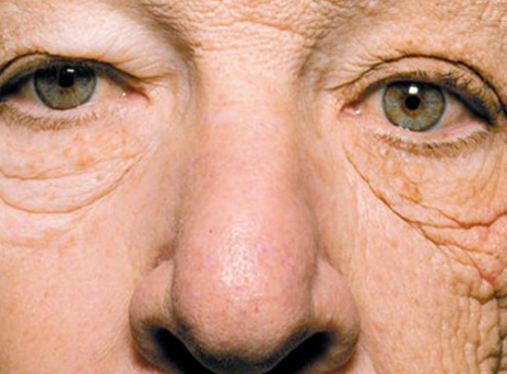 Γέρασε στο τιμόνι: Οδηγός νταλίκας παραμορφώθηκε από τον ήλιο (εικόνα)