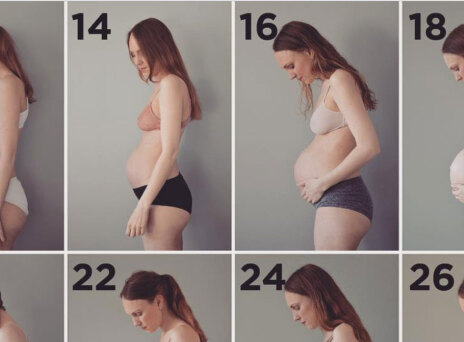 Τρίδυμη κύηση: Μία μητέρα δείχνει το σώμα της κατά τη διάρκεια της εγκυμοσύνης και μετά τον τοκετό (εικόνες)