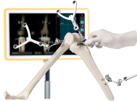 Προηγμένη τεχνολογία ρομποτικής πλοήγησης στην Ευρωκλινική Αθηνών