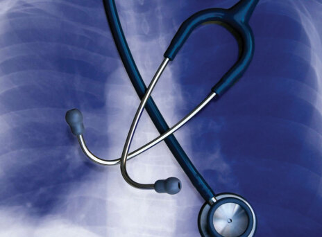 Ο ALK θετικός καρκίνος του πνεύμονα και πώς αντιμετωπίζεται