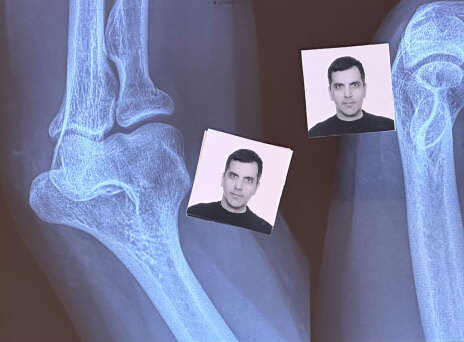 Φωτογραφίες ταυτότητας πάνω σε ακτινογραφία