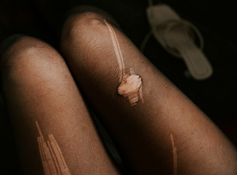 Το απόλυτο hack για να μη σκίζονται τα καλσόν 