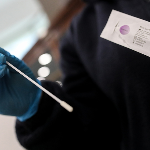 Δωρεάν rapid test από τον ΕΟΔΥ