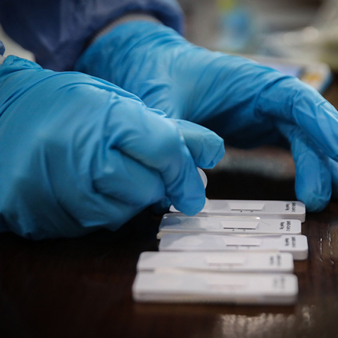 Δωρεάν rapid test από τον ΕΟΔΥ