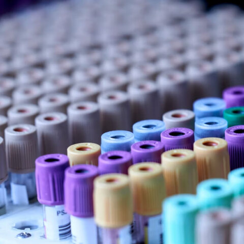 20 τα κρούσματα στην Ελλάδα που αφορούν στην ευλογιά των πιθήκων