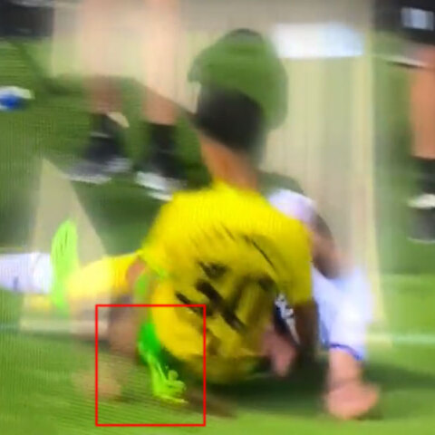 Ο Δημήτρης Γιαννούλης γυρνά τον αστράγαλό του στον αγώνα της Νόριτς με τη Γουίγκαν