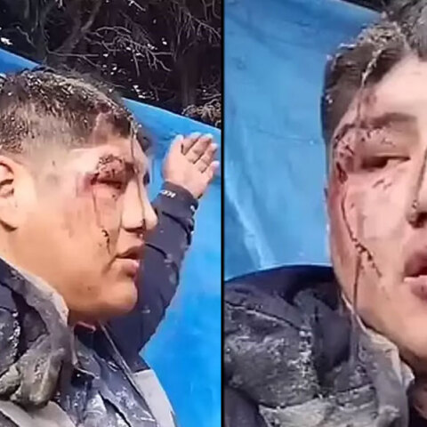 Ο 30χρονος στη Βολιβία που ισχυρίζεται ότι τον έθαψαν ζωντανό ως «θυσία» στη Μητέρα Γη