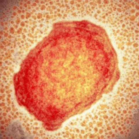 Ιός της ευλογιάς των πιθήκων 