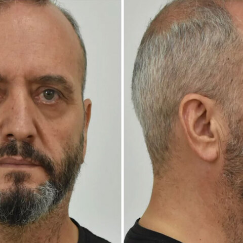 Ο 53χρονος στον Κολωνό που βίαζε και εξέδιδε τη 12χρονη μαθήτρια