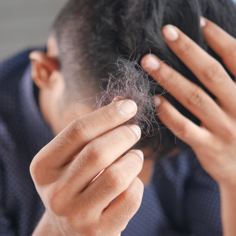 Ιάπωνες ερευνητές καλλιέργησαν με επιτυχία στο εργαστήριο θυλάκια τρίχας, ανοίγοντας δρόμο για τη θεραπεία της φαλάκρας.