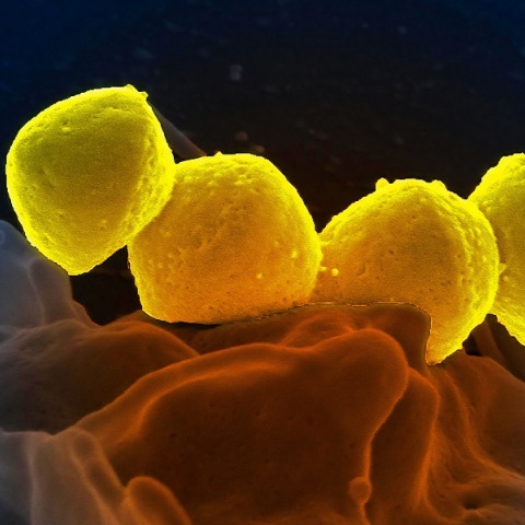 Ανησυχία για στρεπτόκοκκο Α σε σχολεία της Βρετανίας - Έξι παιδιά νεκρά